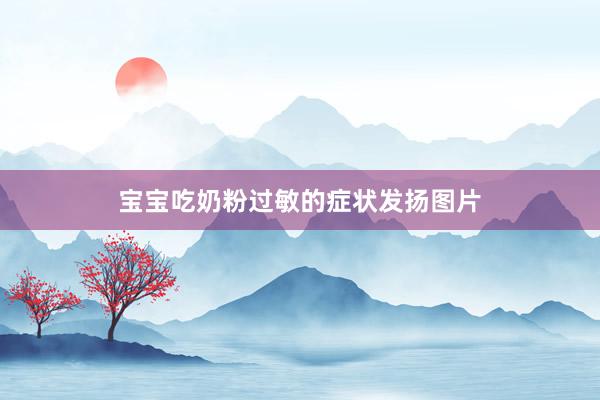 宝宝吃奶粉过敏的症状发扬图片